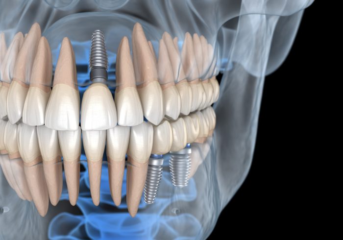 Dental technology stock photo